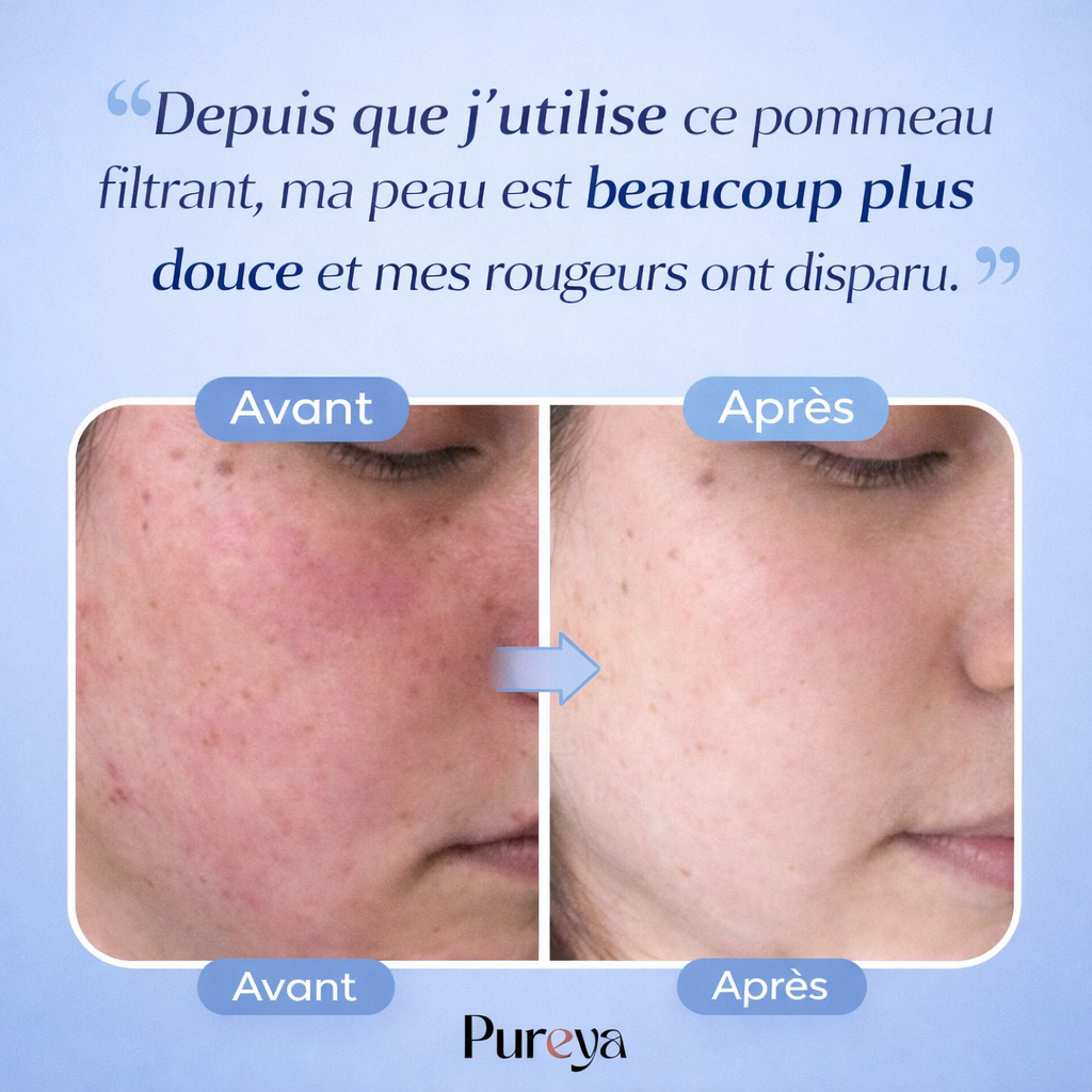 Pommeau Filtrant PUREYA